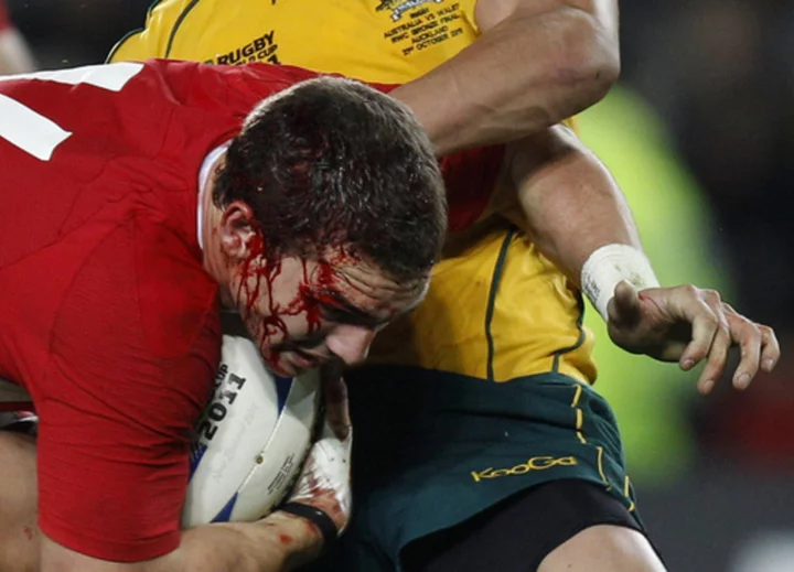 NFL-style lawsuit and brain-injury concerns hang over Rugby World Cup